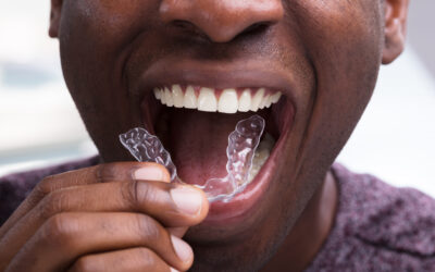 How Night Guards Lead to a Healthier Smile