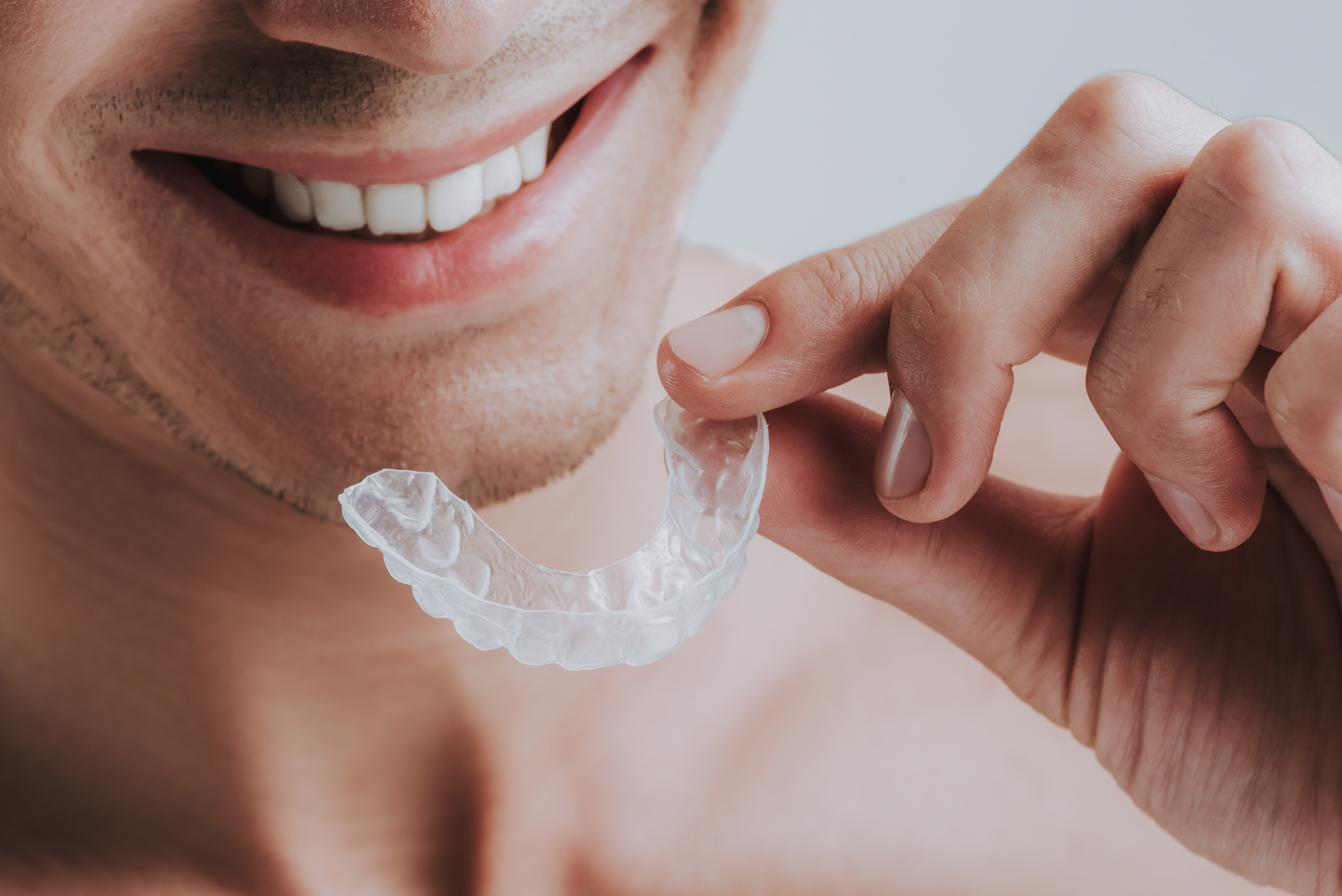 Cheerful young man smiling and holding a transparent mouthguards near his teeth