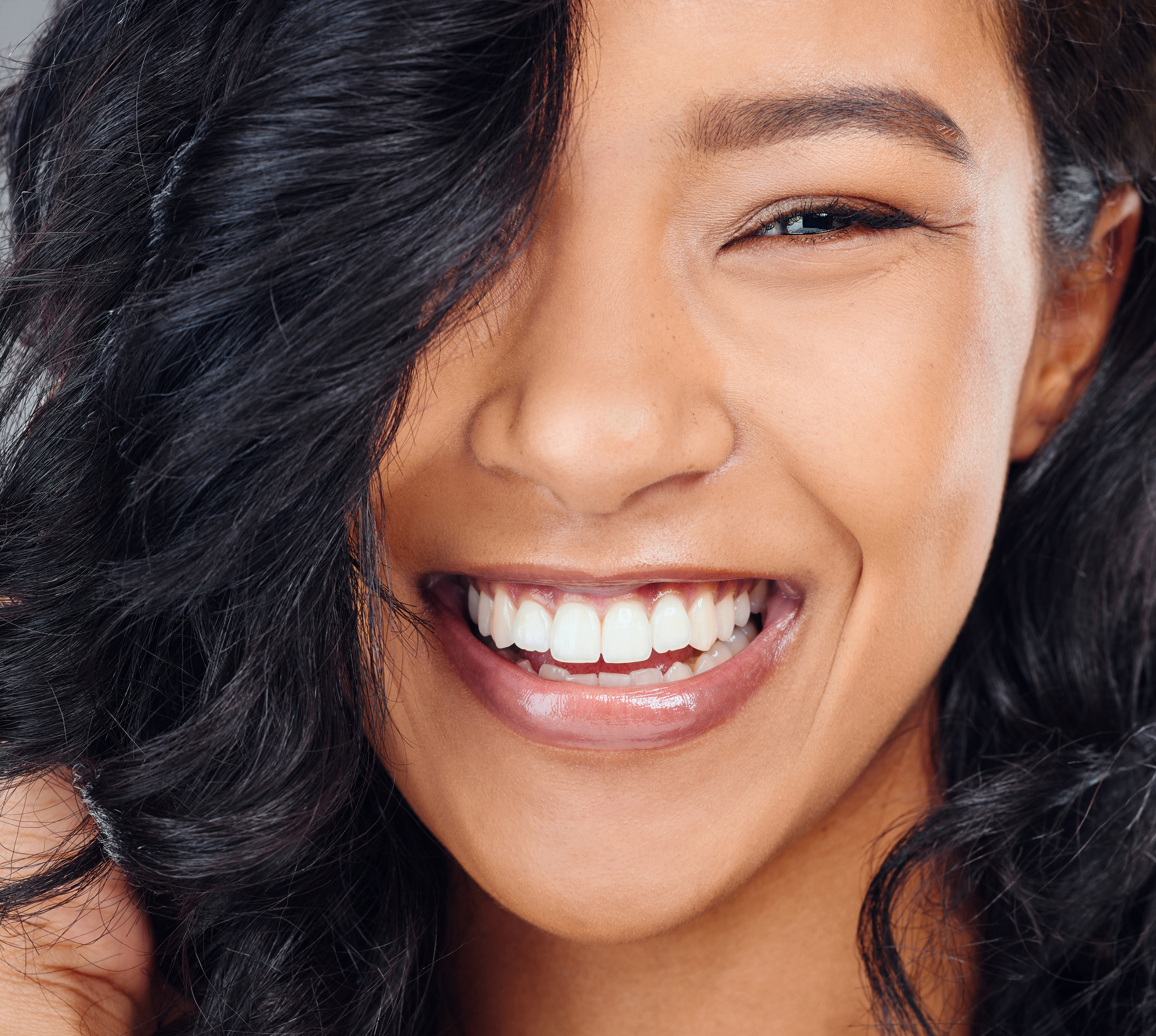 close up of woman with dental implants smiling and laughing