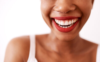 Dentist in Humble, TX Discusses How Dental Veneers Can Correct Various Dental Flaws