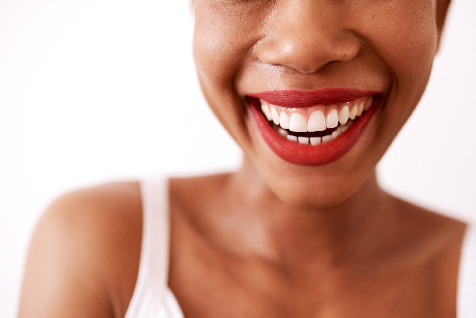 close up of black woman's smile with dental veneers and red lipstick